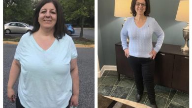 to Know About Weight Loss Surgery