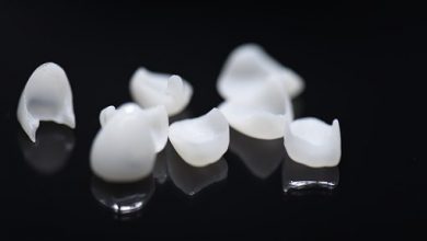 Porcelain veneers